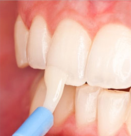 Preventive Dental Therapy